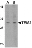 Western blot - TEM2 Antibody from Signalway Antibody (24591) - Antibodies.com
