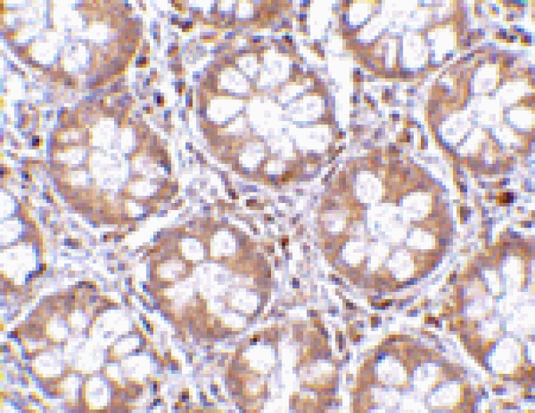 Immunohistochemistry - TEM2 Antibody from Signalway Antibody (24591) - Antibodies.com