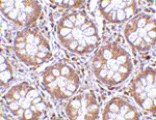 Immunohistochemistry - TEM2 Antibody from Signalway Antibody (24591) - Antibodies.com