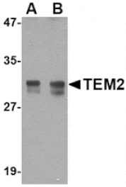 Western blot - TEM2 Antibody from Signalway Antibody (24592) - Antibodies.com