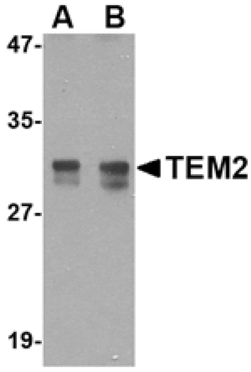 Western blot - TEM2 Antibody from Signalway Antibody (24592) - Antibodies.com