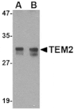 Western blot - TEM2 Antibody from Signalway Antibody (24592) - Antibodies.com