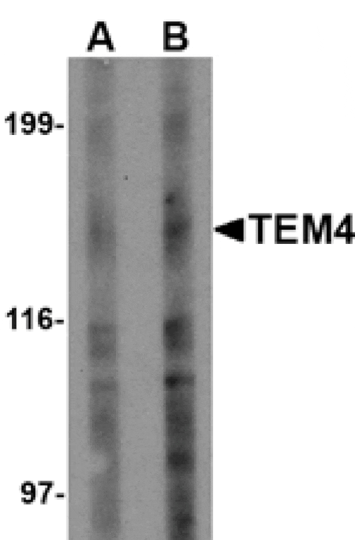 Western blot - TEM4 Antibody from Signalway Antibody (24593) - Antibodies.com