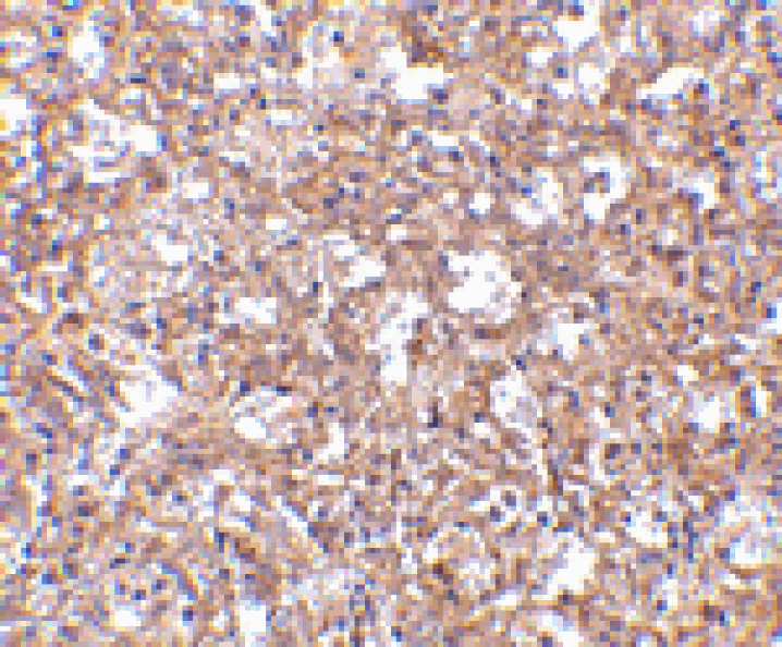 Immunohistochemistry - TEM4 Antibody from Signalway Antibody (24593) - Antibodies.com