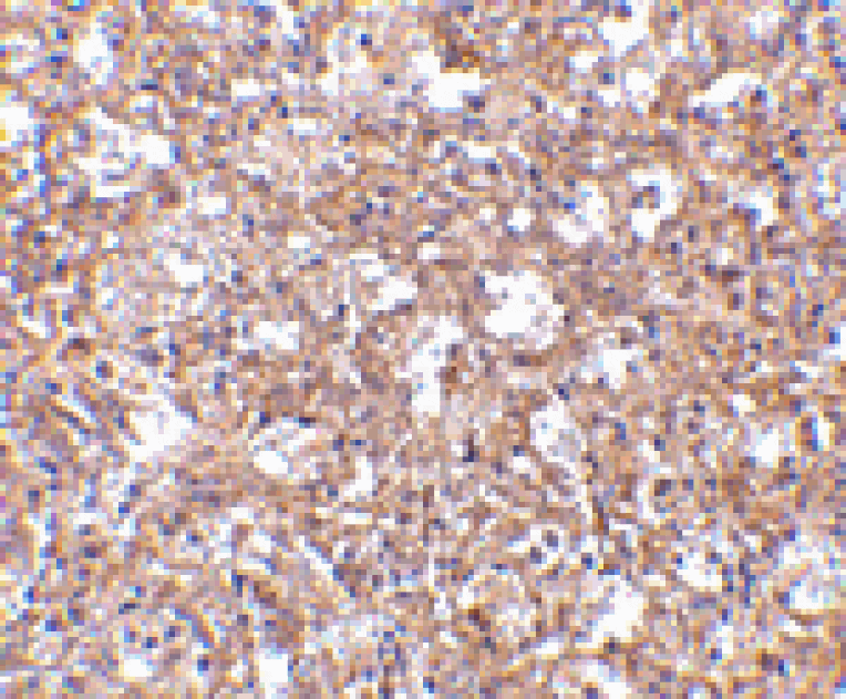 Immunohistochemistry - TEM4 Antibody from Signalway Antibody (24593) - Antibodies.com