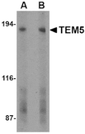 Western blot - TEM5 Antibody from Signalway Antibody (24594) - Antibodies.com