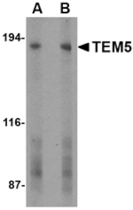 Western blot - TEM5 Antibody from Signalway Antibody (24594) - Antibodies.com