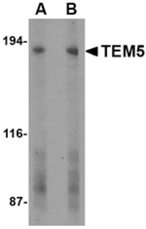 Western blot - TEM5 Antibody from Signalway Antibody (24594) - Antibodies.com