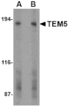 Western blot - TEM5 Antibody from Signalway Antibody (24594) - Antibodies.com