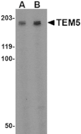 Western blot - TEM5 Antibody from Signalway Antibody (24595) - Antibodies.com