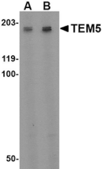 Western blot - TEM5 Antibody from Signalway Antibody (24595) - Antibodies.com