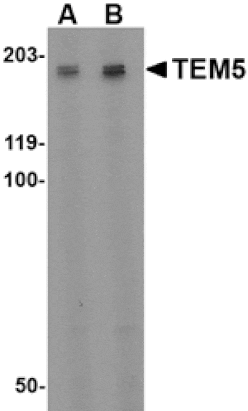 Western blot - TEM5 Antibody from Signalway Antibody (24595) - Antibodies.com