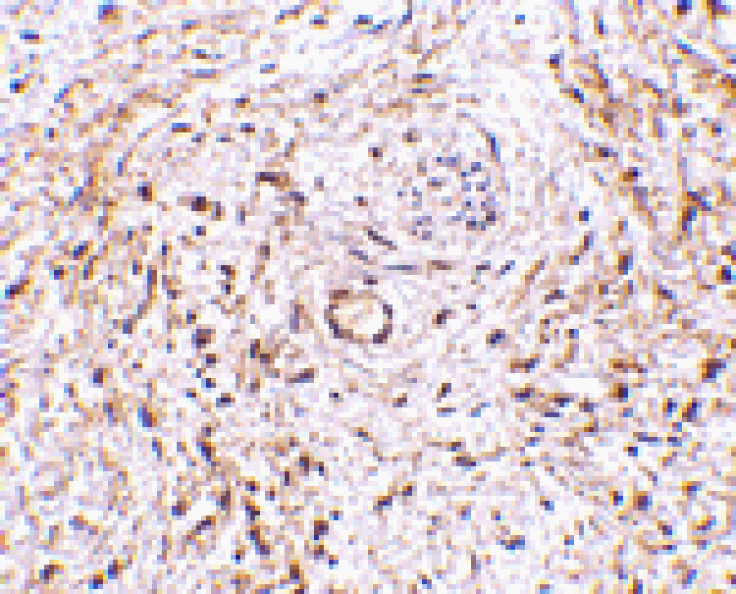 Immunohistochemistry - TEM5 Antibody from Signalway Antibody (24595) - Antibodies.com