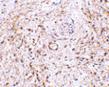 Immunohistochemistry - TEM5 Antibody from Signalway Antibody (24595) - Antibodies.com