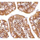 Immunohistochemistry - ZBP1 Antibody from Signalway Antibody (24608) - Antibodies.com