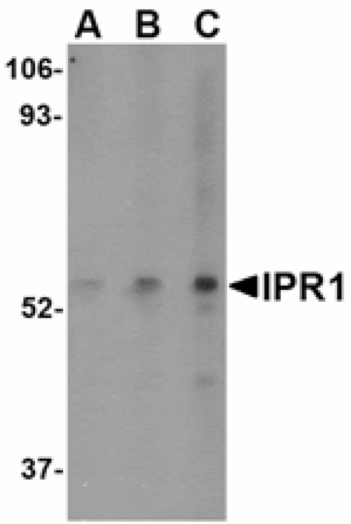 Western blot - IPR1 Antibody from Signalway Antibody (24611) - Antibodies.com