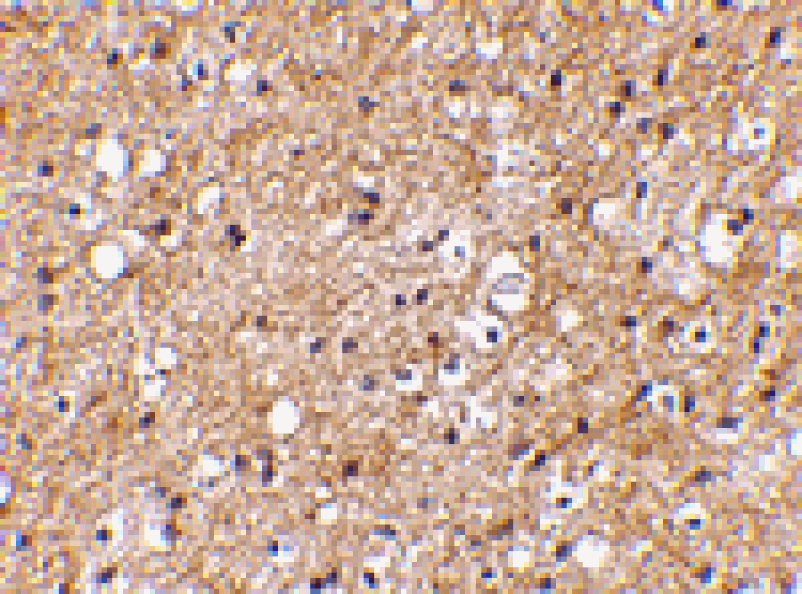 Immunohistochemistry - IPR1 Antibody from Signalway Antibody (24611) - Antibodies.com