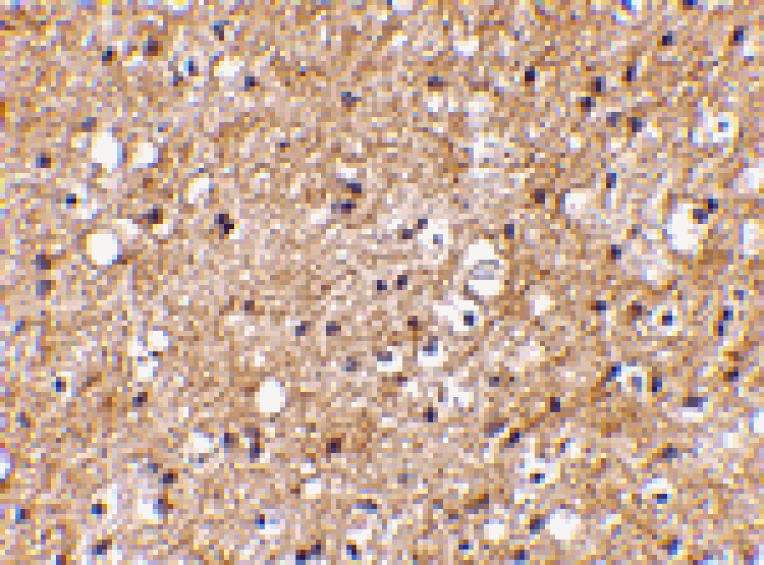 Immunohistochemistry - IPR1 Antibody from Signalway Antibody (24611) - Antibodies.com