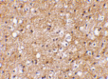 Immunohistochemistry - IPR1 Antibody from Signalway Antibody (24611) - Antibodies.com
