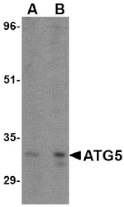Western blot - ATG5 Antibody from Signalway Antibody (24623) - Antibodies.com