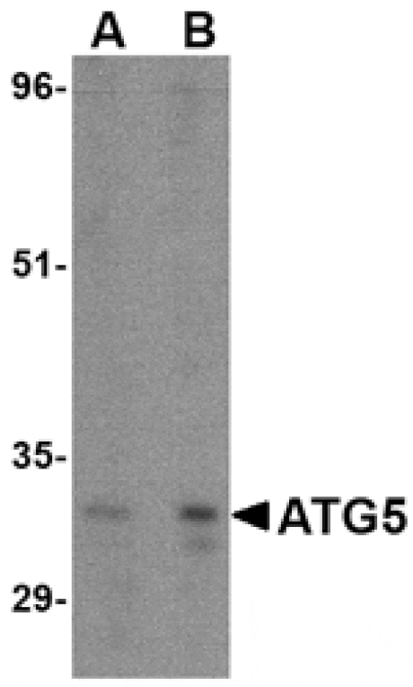 Western blot - ATG5 Antibody from Signalway Antibody (24623) - Antibodies.com