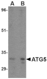 Western blot - ATG5 Antibody from Signalway Antibody (24623) - Antibodies.com