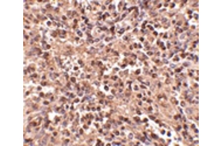 Immunohistochemistry - ATG5 Antibody from Signalway Antibody (24623) - Antibodies.com