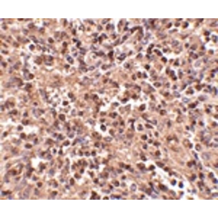Immunohistochemistry - ATG5 Antibody from Signalway Antibody (24623) - Antibodies.com