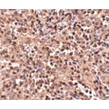 Immunohistochemistry - ATG5 Antibody from Signalway Antibody (24623) - Antibodies.com
