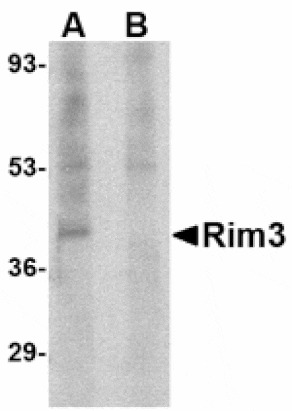 Western blot - Rim3 Antibody from Signalway Antibody (24633) - Antibodies.com