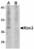 Western blot - Rim3 Antibody from Signalway Antibody (24633) - Antibodies.com