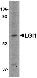 Western blot analysis of LGI1 in HeLa cell lysate with LGI1 antibody at 2 µg/mL.
