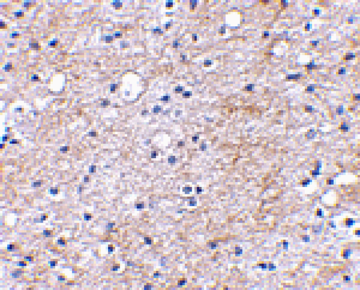 Immunohistochemistry - LGI1 Antibody from Signalway Antibody (24642) - Antibodies.com