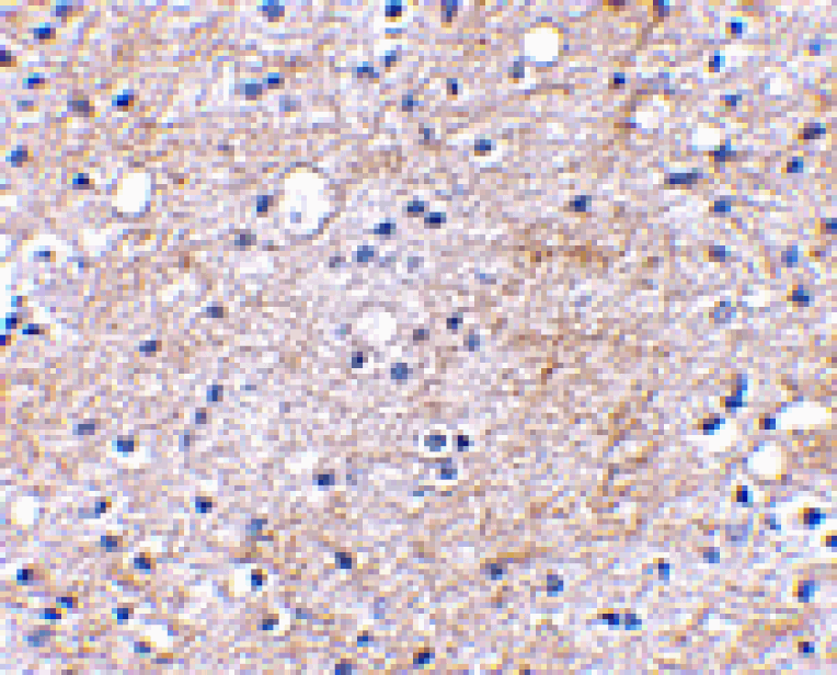 Immunohistochemistry - LGI1 Antibody from Signalway Antibody (24642) - Antibodies.com