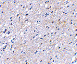 Immunohistochemistry - BAP3 Antibody from Signalway Antibody (24647) - Antibodies.com