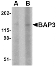 Western blot - BAP3 Antibody from Signalway Antibody (24648) - Antibodies.com