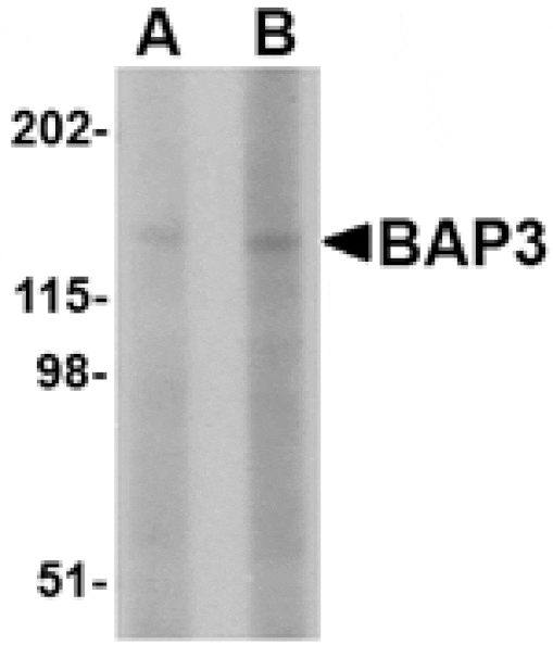 Western blot - BAP3 Antibody from Signalway Antibody (24648) - Antibodies.com