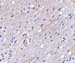 Immunohistochemistry - BAP3 Antibody from Signalway Antibody (24648) - Antibodies.com