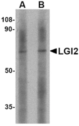 Western blot - LGI2 Antibody from Signalway Antibody (24655) - Antibodies.com