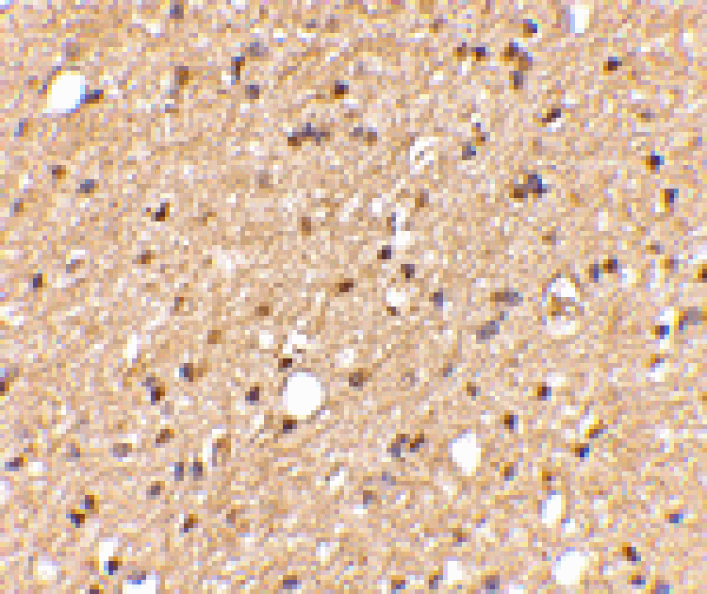 Immunohistochemistry - LGI2 Antibody from Signalway Antibody (24655) - Antibodies.com