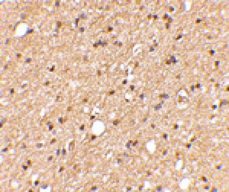 Immunohistochemistry - LGI2 Antibody from Signalway Antibody (24655) - Antibodies.com