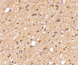 Immunohistochemistry - LGI2 Antibody from Signalway Antibody (24655) - Antibodies.com