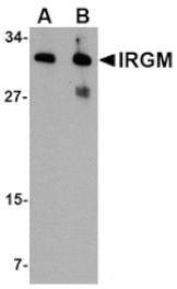 Western blot - IRGM Antibody from Signalway Antibody (24661) - Antibodies.com