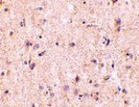 Immunohistochemistry - IRGM Antibody from Signalway Antibody (24661) - Antibodies.com