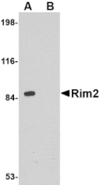 Western blot - Rim2 Antibody from Signalway Antibody (24685) - Antibodies.com