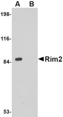 Western blot - Rim2 Antibody from Signalway Antibody (24685) - Antibodies.com
