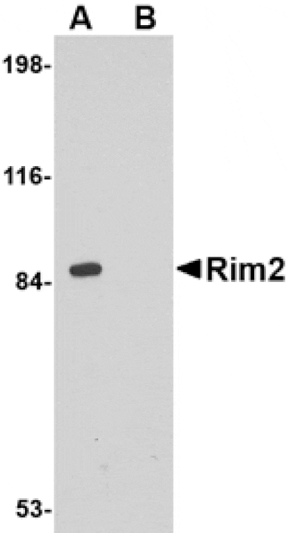 Western blot - Rim2 Antibody from Signalway Antibody (24685) - Antibodies.com