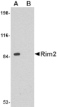 Western blot - Rim2 Antibody from Signalway Antibody (24685) - Antibodies.com
