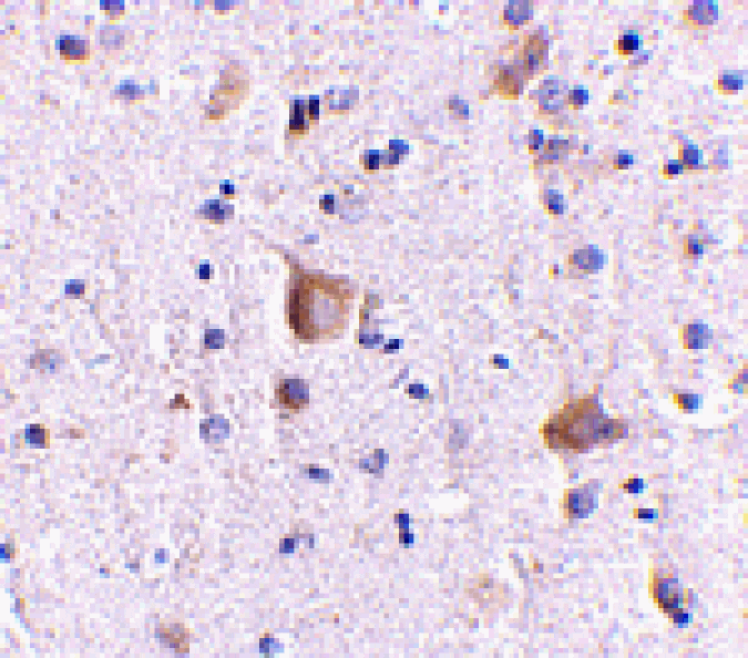 Immunohistochemistry - Rim2 Antibody from Signalway Antibody (24685) - Antibodies.com