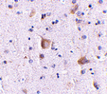 Immunohistochemistry - Rim2 Antibody from Signalway Antibody (24685) - Antibodies.com